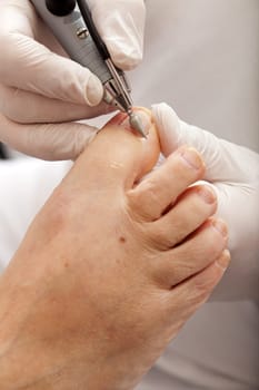 Surface of toe nails are polished