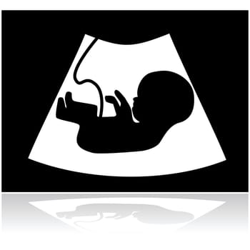 Concept illustration showing a baby inside a mother's womb in an ultrasound scan