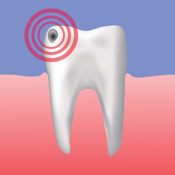 colorful illustration with hole in the tooth for your design