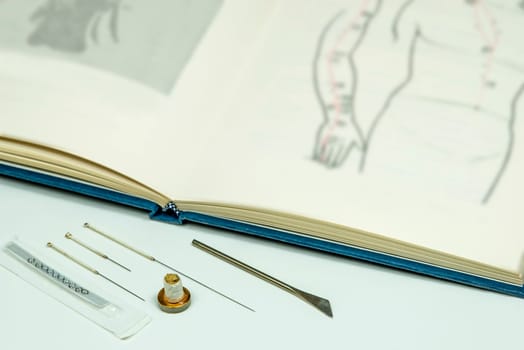 Acupuncture,Chinese medicine