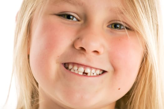 the little girl with missing teeth