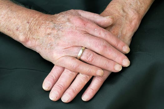 Hands of an old couple