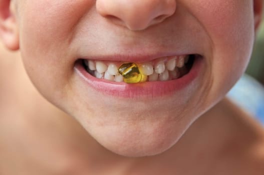 Tooth gap