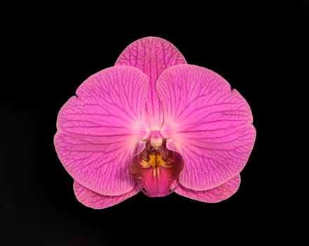 doritaenopsis chian-huey red rose stars orchid isolated black background