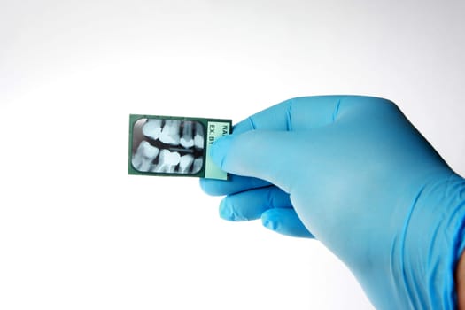 Dentist checking an x-ray of human teeth. Isolated on white