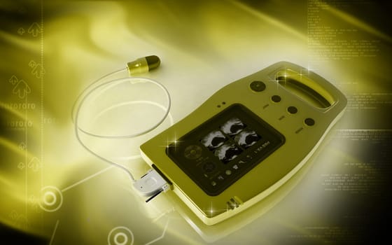 Digital illustration of palm bladder scanner in colour background