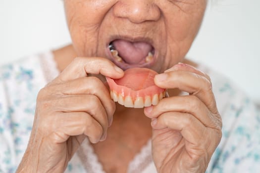 Asian elderly woman patient holding to use denture, healthy strong medical concept.