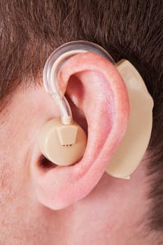 Close-up Of Hearing Aid On The Man's Ear