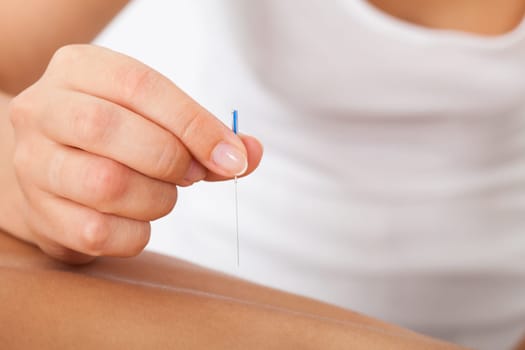Close-up Of The Hand Stimulating Acupuncture Needle