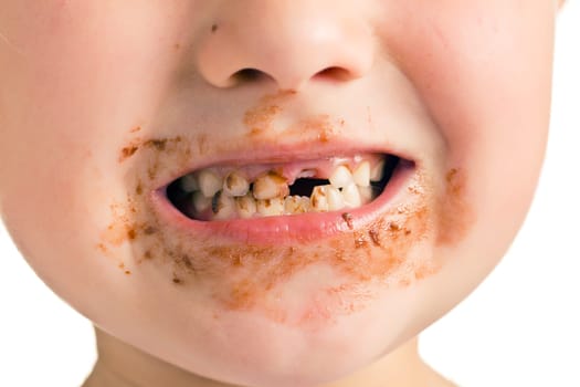the child with a dirty mouth and missing tooth