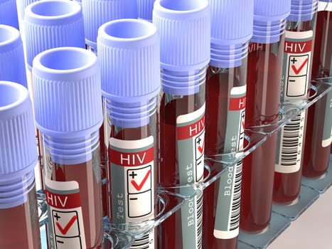 Image concept with the result of the HIV test.