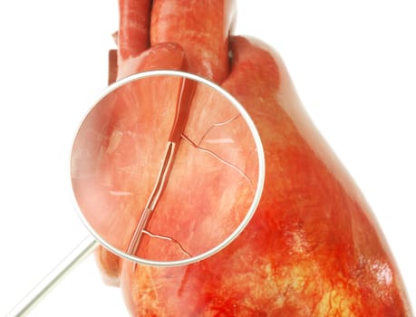 Healthy heart with visible coronary artery in cross section