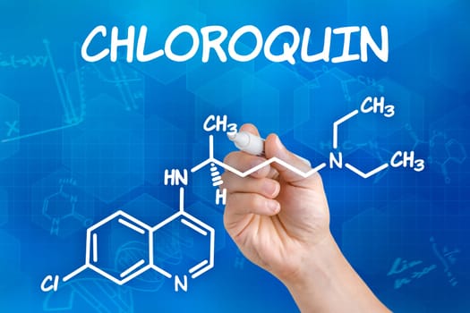 Hand with pen draws chemical structural formula of chloroquine