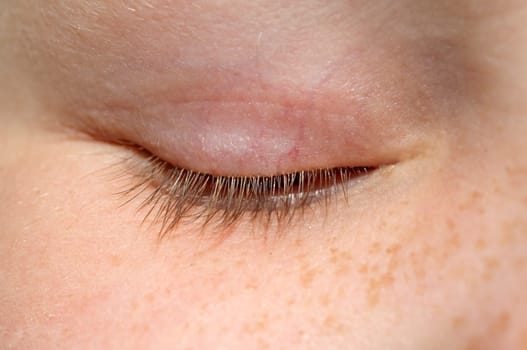 Eyelash,eye  Lid