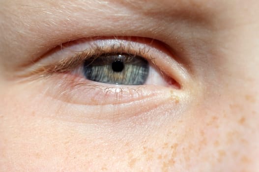 Eye,Eyelid,iris,Maedchenauge