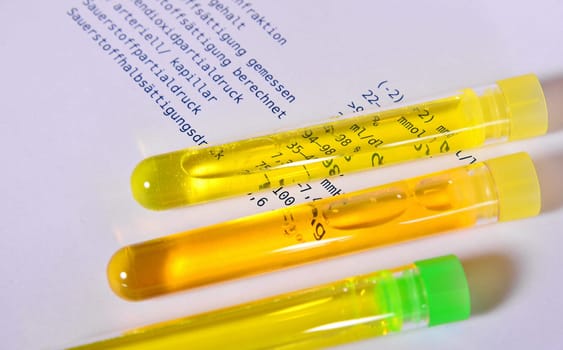Urine Test Laboratory Urine