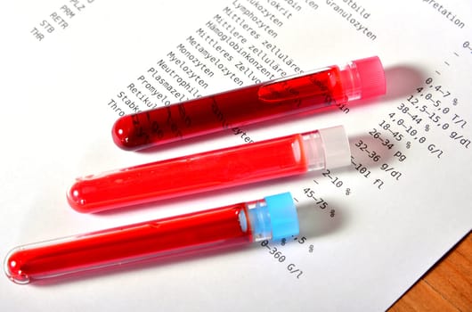 Laboratory Blood Test Laboratory Medicine