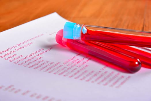 Laboratory Blood Test Laboratory Medicine
