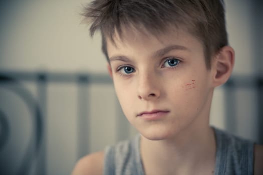 Head and Shoulder Shot of a Serious Young Boy with Small Scars on his Face, Staring Straight at the Camera.