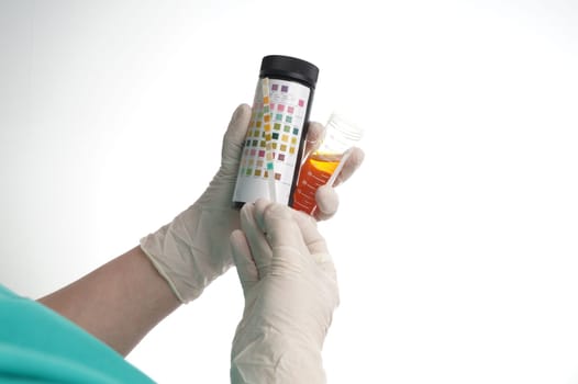 Urine test stripes examined by a nurse. Lab sample