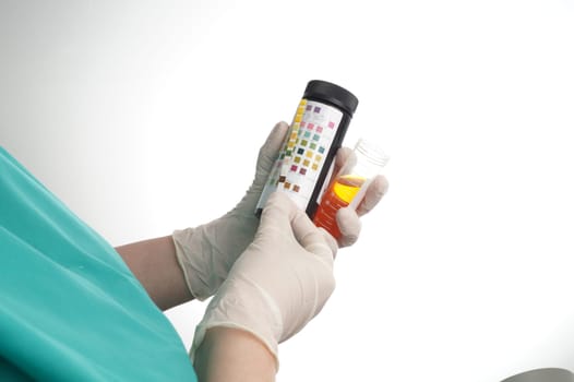 Urine test stripes examined by a nurse. Lab sample