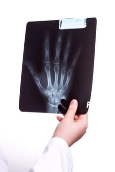 Doctor exams a X Ray picture of her Patients Hand