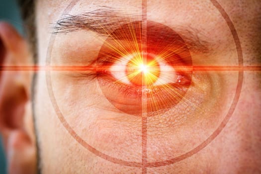 Laser eyes
