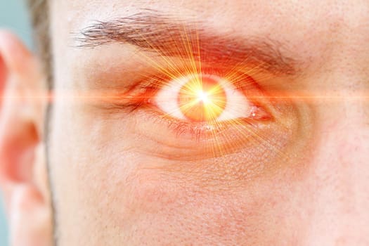 Laser eyes