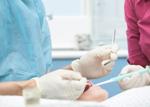 Visiting the dentist having a checkup, clean and work done. Close up images of the dentist working on and in a mouth