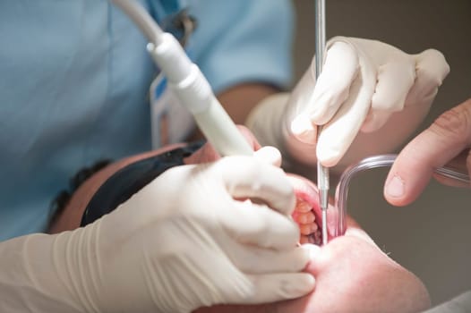 Visiting the dentist having a checkup, clean and work done. Close up images of the dentist working on and in a mouth