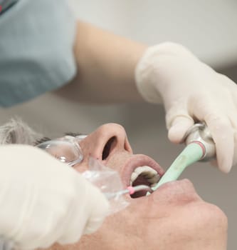 Visiting the dentist having a checkup, clean and work done. Close up images of the dentist working on and in a mouth
