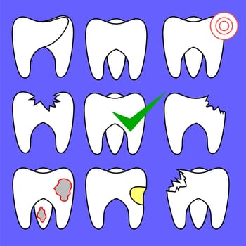 Set of Rotten Teeth and Healthy Isolated on Blue Background. Dental Treatment. SevereToothache. Filled Tooth. Symbol of Carre and Health.