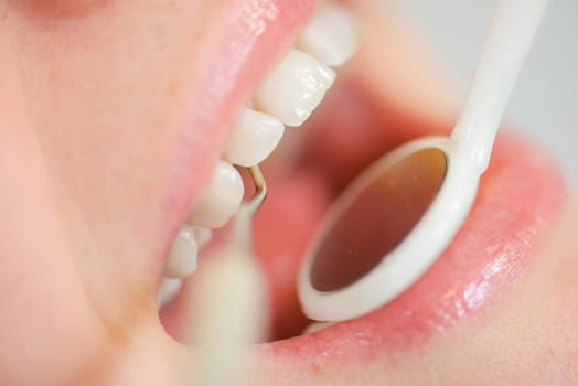 Taking a look in a woman's mouth