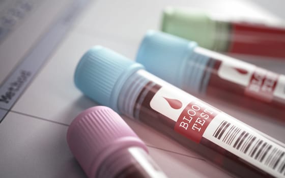 Tubes with blood for testing scientific and medical. Depth of field with focus on the Blood Test label.