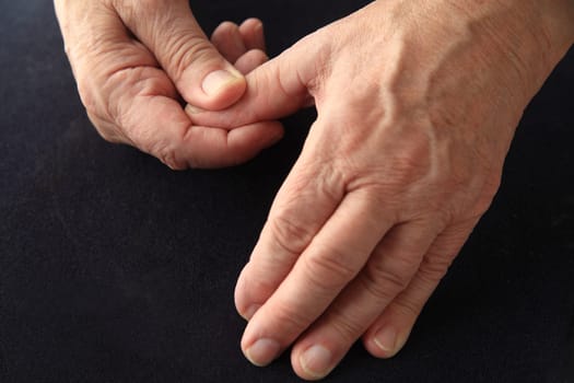Older man has an aching thumb.