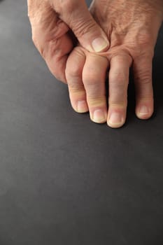 Older man rubs his painful knuckles.