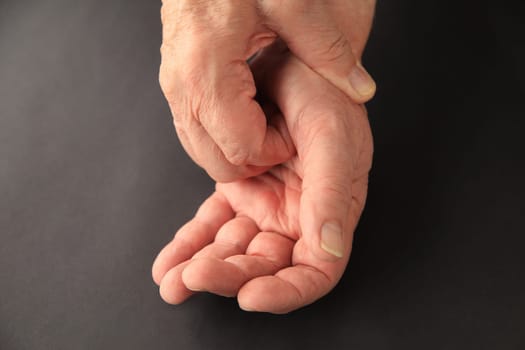 Senior man scratches an irritated area on his palm.