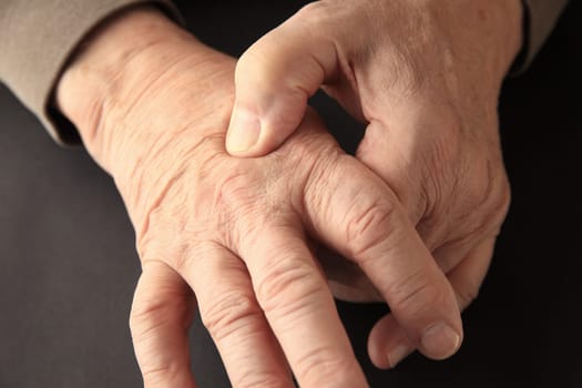 Senior man indicates where he feels pain on the back of his hand.