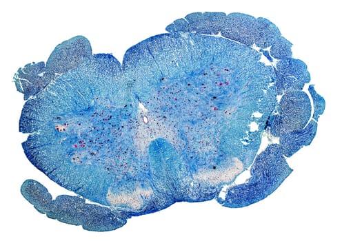 blue colored microscopic cross section of a spinal cord from a rat