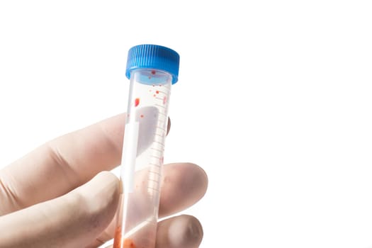 Hand with protective glove holding the medical vial