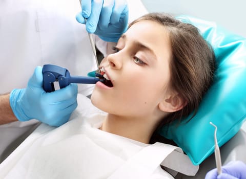 a child in a dental chair during a dental treatment. treatment of tooth loss,a child at the dentist. tooth decay in children,principles of oral hygiene. teeth sealing,child at the dentist. a dental office,a child in a dental chair\nlight-curing seal,a child in a dental office