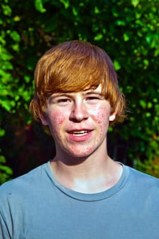 portrait of cute boy in puberty with acne