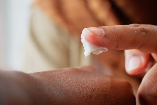 Applying a rich cream to hydrate and nourish the skin on the arm.