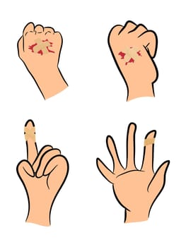Set of Injured finger, hand wrapped in adhesive bandage, plaster  with red  blood puddle. Vector illustration isolated on white background.