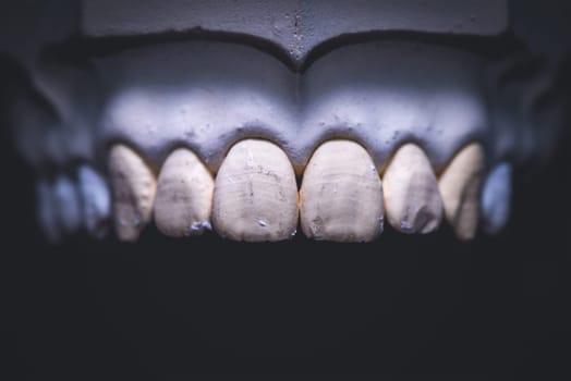 Dental prosthesis, artificial tooth. Photo of artificial teeth made in the dental laboratory.