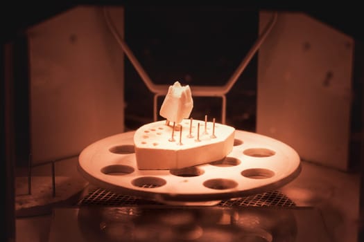 Dental prosthesis, artificial tooth. Photo of artificial teeth made in the dental laboratory.