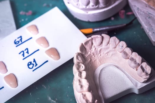 Dental prosthesis, artificial tooth. Photo of artificial teeth made in the dental laboratory.