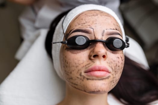 Beautician doing hardware carbon peeling to a young beautiful client in a headdress in goggles lying on a sofa in a beauty salon. Facial cleansing concept. Cosmetology services.