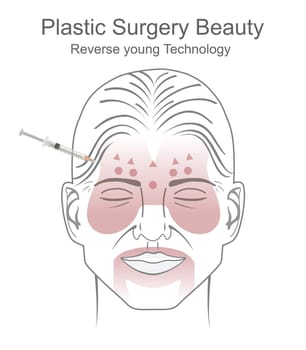Plastic surgery is a surgical specialty involving the restoration, reconstruction, or alteration of the human body. It includes cosmetic or aesthetic surgery, reconstructive surgery, craniofacial surgery, hand surgery, microsurgery, and the treatment of burns.