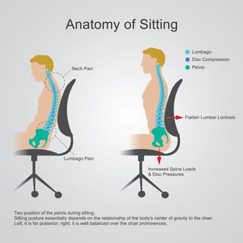 The lumbar region is sometimes referred to as the lower spine, or as an area of the back in its proximity.